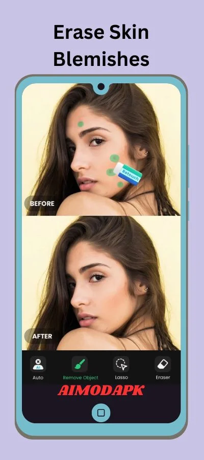 Erase skins blemishes